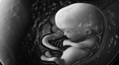 Фото УЗИ 8 неделя беременности