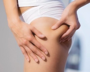 Все о целлюлите