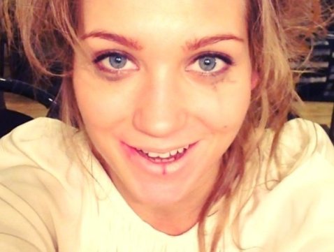 Кристина Асмус испугала своих поклонников